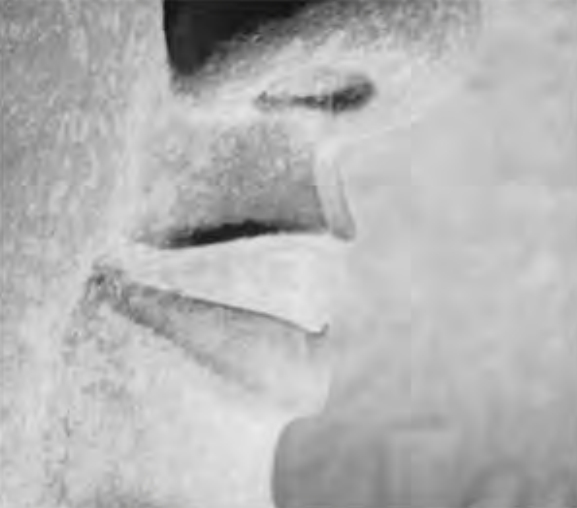 Figure 3.11. Detail of right vermilion border