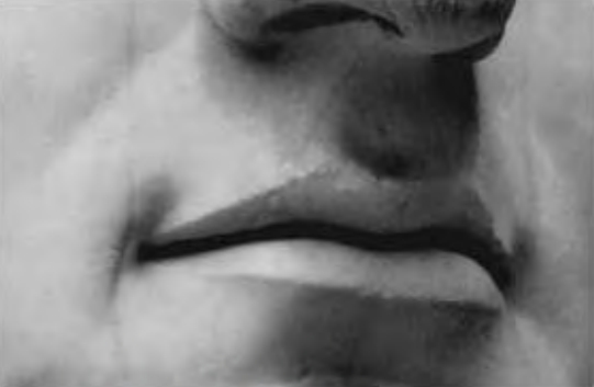 Figure 3.6. Imperfect lips