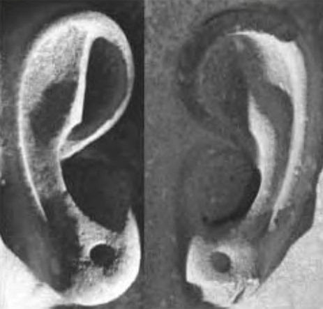 4.12b -Right ear and left ear of Ramses outside Luxor Temple